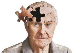 ۶ توصیه برای مقابله با خطر ابتلا به آلزایمر